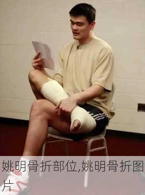 姚明骨折部位,姚明骨折图片